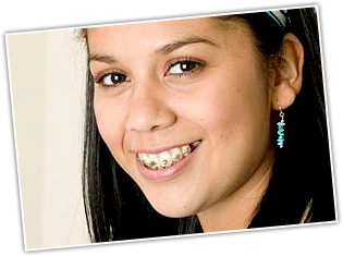 photo of girl with braces